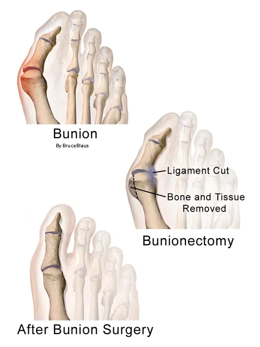 6 CE Hour Advanced Medical Foot Massage (Computer-Based Live Interactive Webinar)