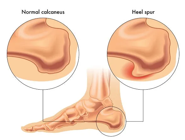 6 CE Hour Advanced Medical Foot Massage (Computer-Based Live Interactive Webinar)