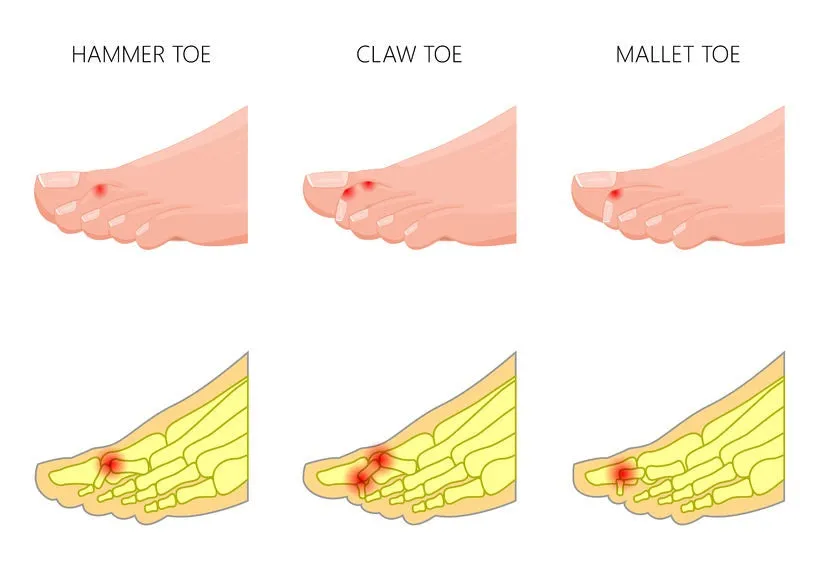 6 CE Hour Advanced Medical Foot Massage (Computer-Based Live Interactive Webinar)